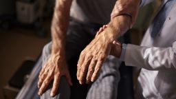 Close up of unrecognizable doctor examining man's arm during an appointment in the office.